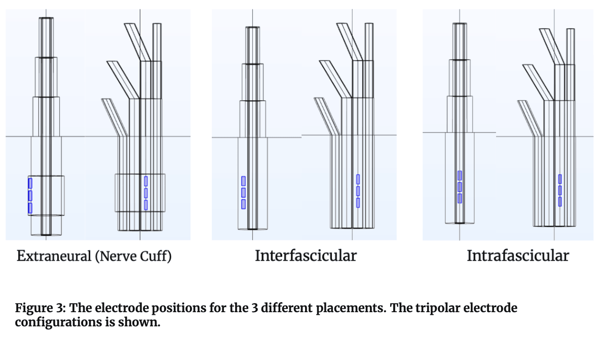 Figure 3. Tripolar electrode configurations for extraneural, interfascicular, and intrafascicular placements.